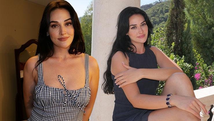 Esra Bilgiç'ten Otoparkta Büyüleyici Pozlar! Güzelliğiyle Etkiledi