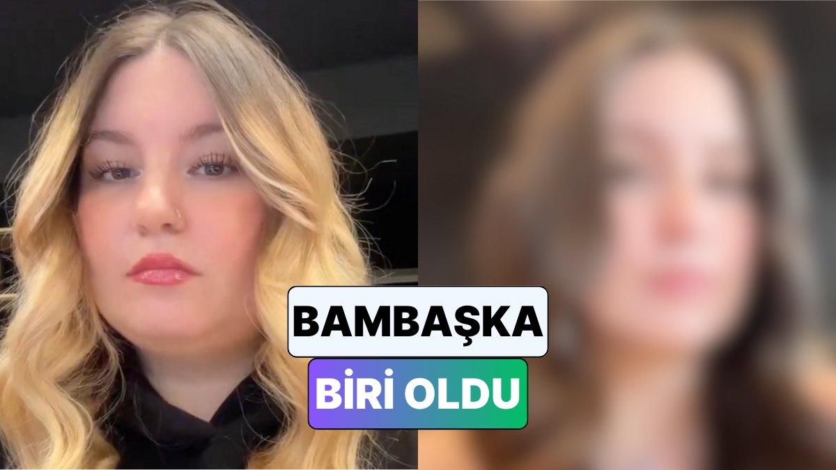 30 Kilo Vererek Zayıflayan Kadın, Yüzdeki Değişimi Paylaştı