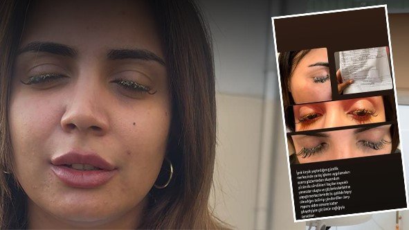 Güzellik Salonu İçinde Yapıştırıcı Gözüne Kaçan Genç Kadın Tehlikede