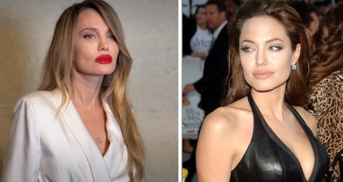 Bazıları Estetik, Bazıları Dublör Zannetti: Angelina Jolie'nin Yüzündeki Değişim Şaşırttı!