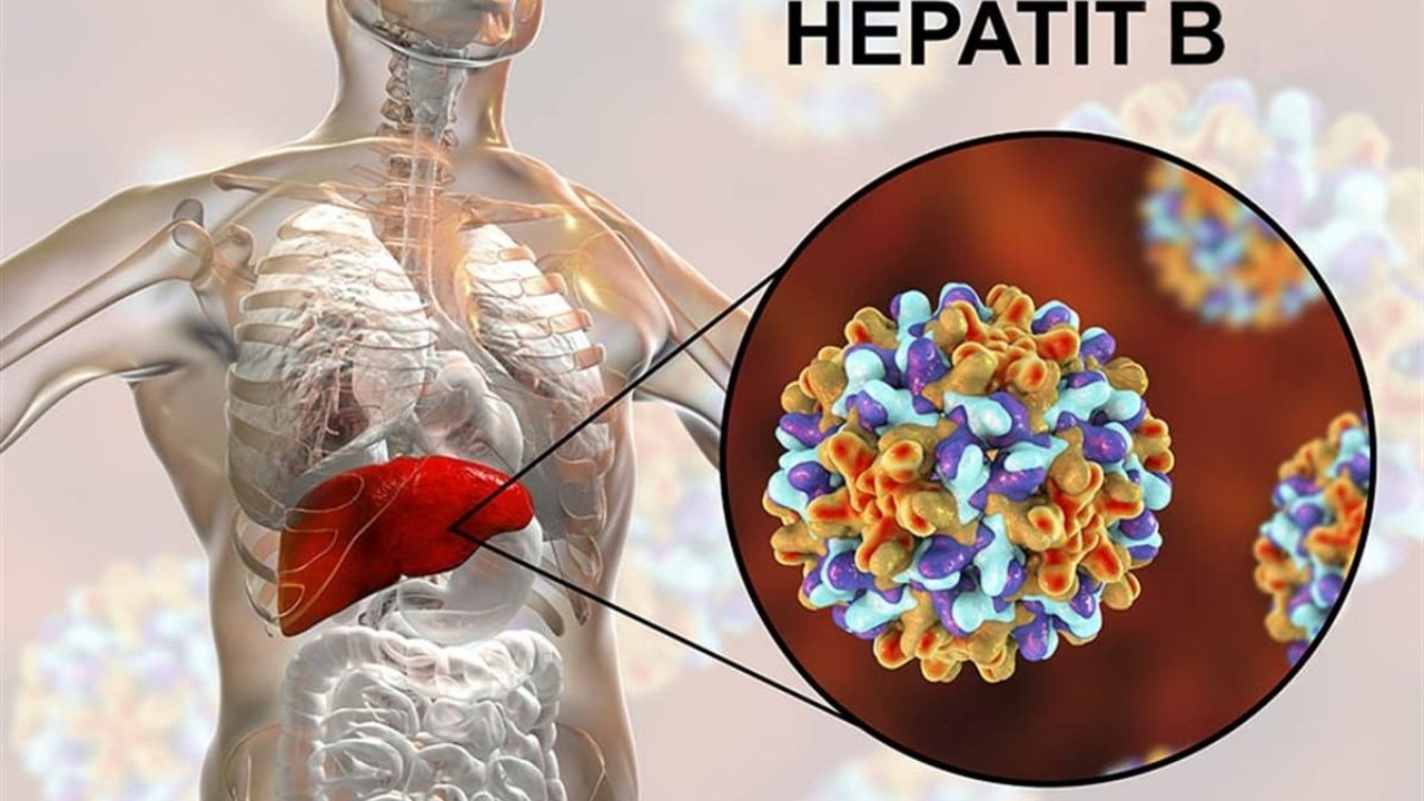 Hepatit B Nedir Belirtileri Nelerdir Ve Nasıl Korunulur?