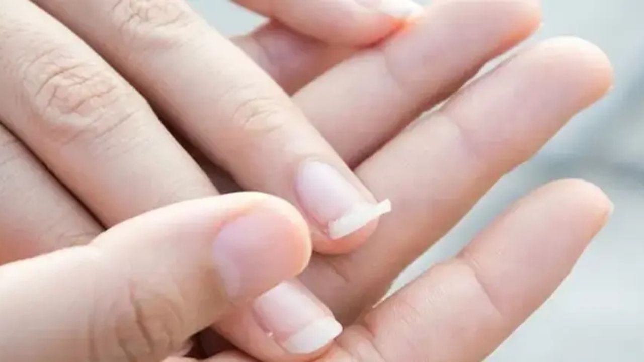 Tırnaklarınız Sürekli Kırılıyorsa Bu Hataları Yapıyor Olabilirsiniz