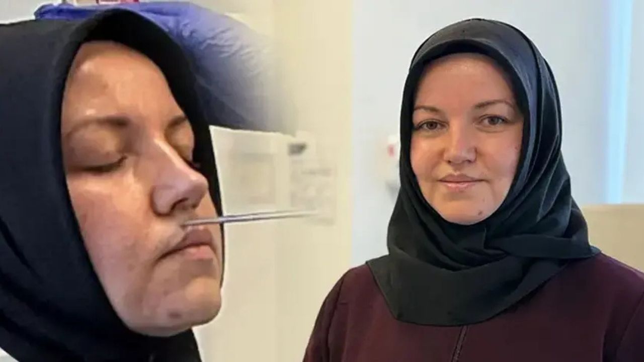 Yıllarca Alerji Sandı, Burun Akıntısının Nedeni Trafik Kazası Çıktı