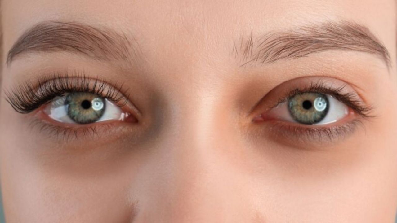 Göz Altı Morlukları Nasıl Geçer? Daha Aydınlık Bir Görünüm İçin Öneriler