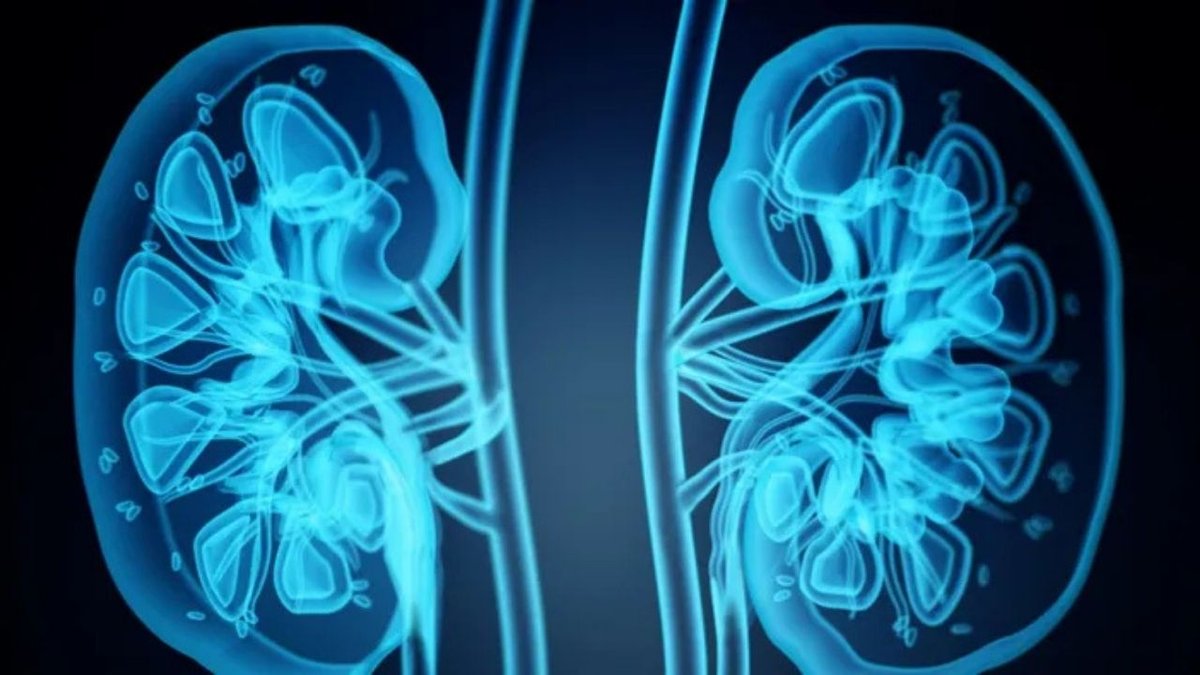 Böbrek Taşına Yol Açan Sofranızdaki Tehlikeler: Aşırı Tuz ve Protein Tüketimi Risk Faktörü