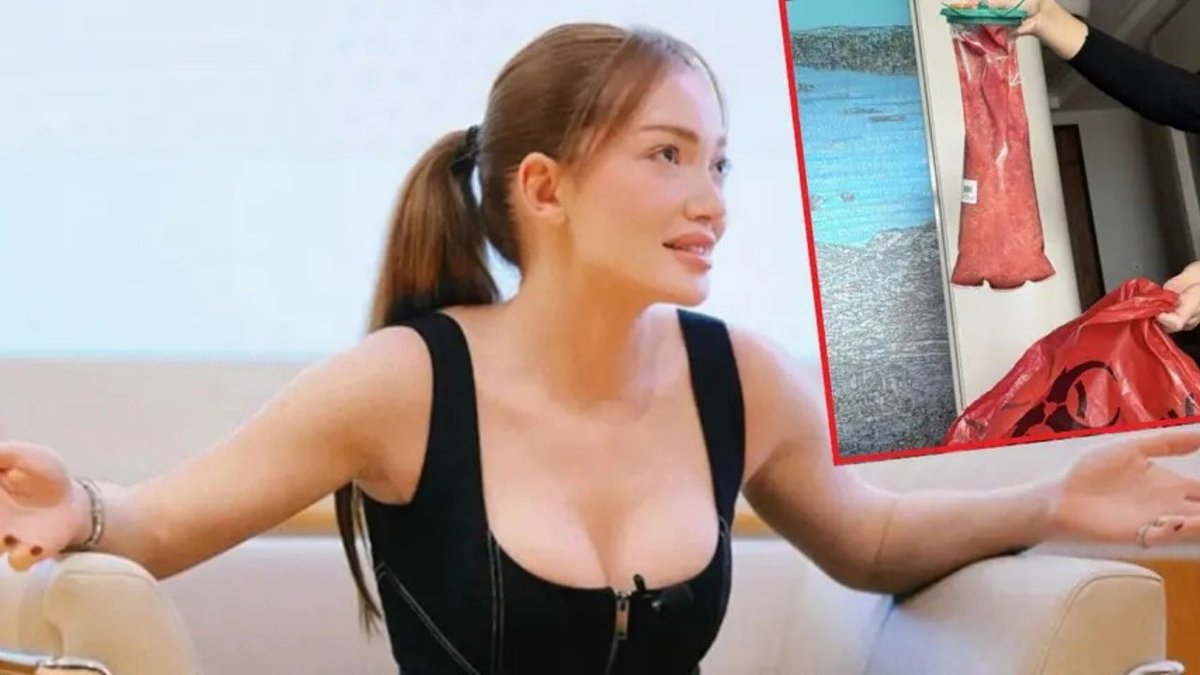 Acil Ameliyata Alınmıştı! Danla Bilic Korkunç Olayı Anlattı: ‘Dikişlerimden Dolgu Akıyordu’