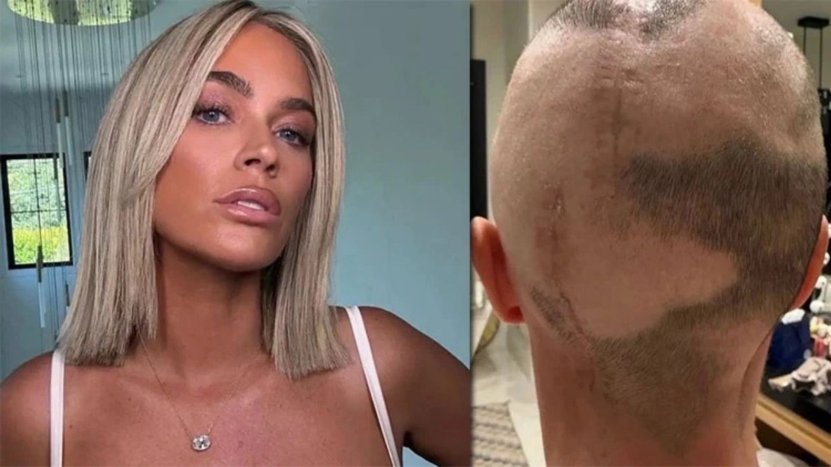 Teddi Mellencamp, Kanserle Savaşını ve Yara İziyle Yaşamanın Gücünü Paylaşıyor: "Peruklardan Bıktım!"
