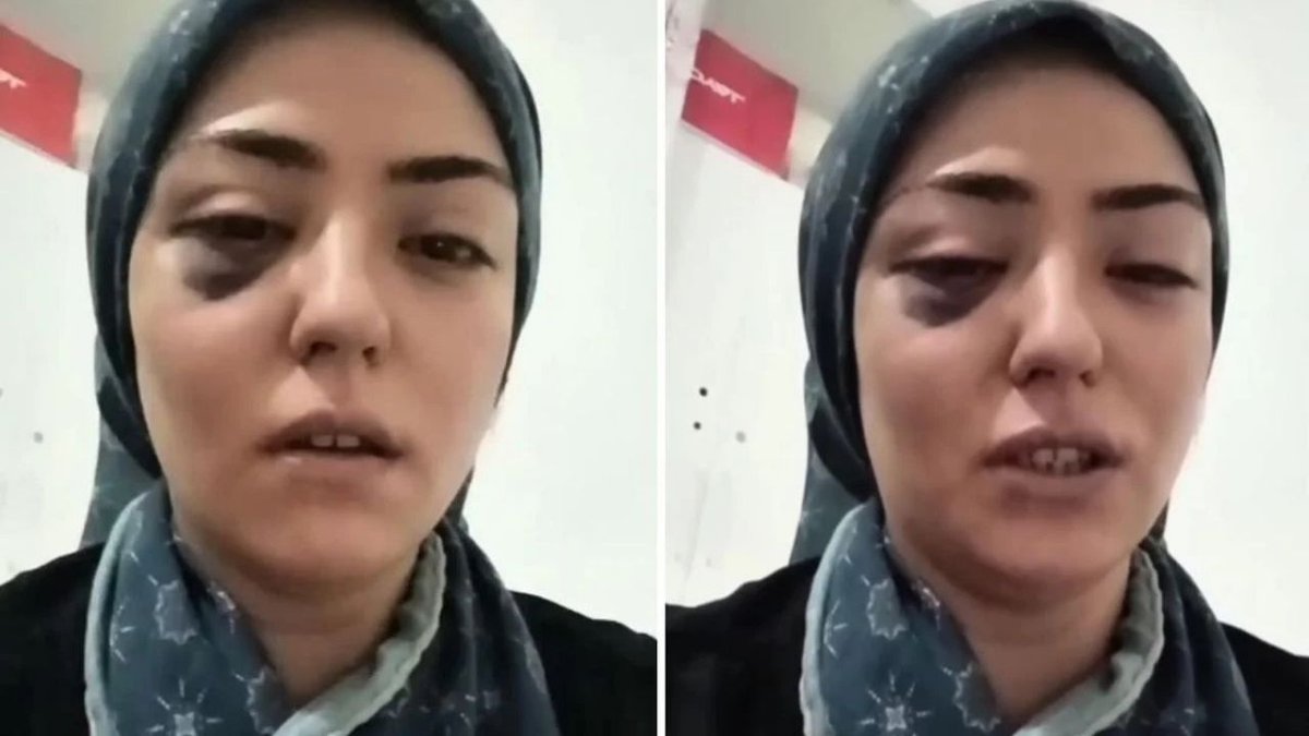 Gaziantep’te Şiddet Gören Anne Adalet Çağrısı Yaptı Sesimi Duyun