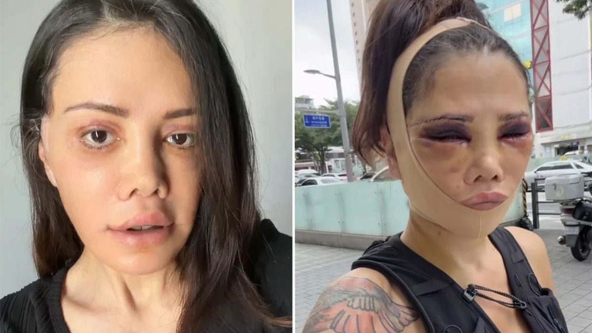Didem Ceran’dan Duygusal Paylaşım Ameliyat Sonrası Yaşadıklarını Anlattı