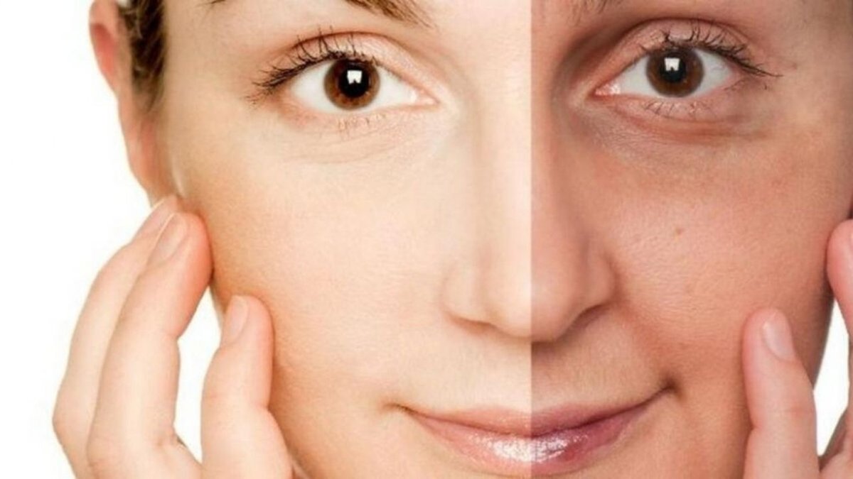 Doğal Besinlerle 10 Yaş Gençleşin: Pahalı Kremlere Gerek Yok