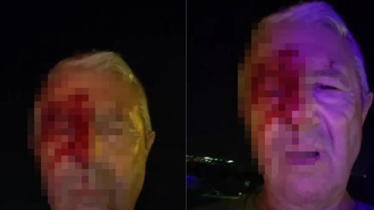 Görev Başında Muhabire Yumruklu Saldırı