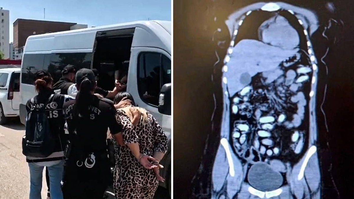Adana Otogarında Uyuşturucu Operasyonu: Midelerinden 1,5 Kilo Metamfetamin Çıktı